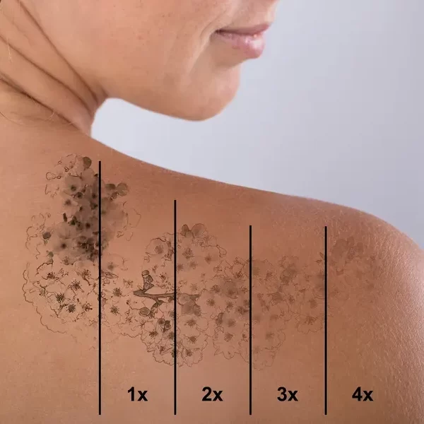 Indepartare tatuaje